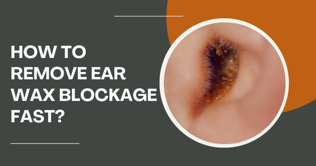 how to remove ear wax blockage fast?